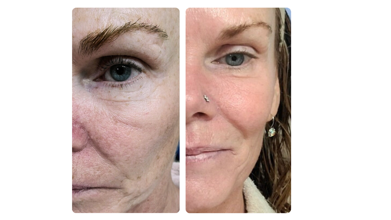 7_days_anon_before_after_2_8e32d96d-b9ca-4e17-8d7e-6689cb82b255.png