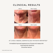 REBEL X neck cream clinical results infographic showing before and after photos at 2 and 3 weeks with improved neck elasticity, reduced crepey skin, and smoother texture in dermatology patient study