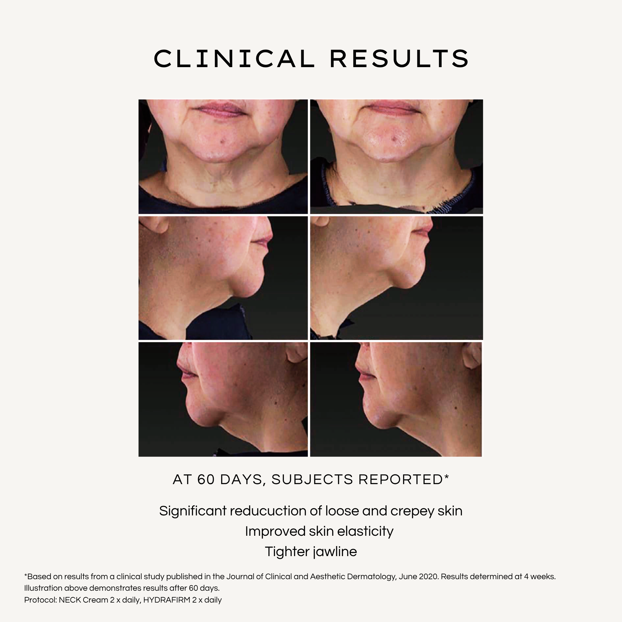 REBEL X neck and decolletage cream clinical results showing before and after photos from multiple angles at 60 days with reported benefits: significant reduction of loose and crepey skin, improved skin elasticity, and tighter jawline demonstrating peptide firming results for mature women