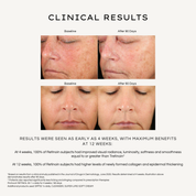 REBEL X retinol serum clinical results infographic showing baseline and after 90 days comparison photos of two mature women with statistical data: 100% showed improved radiance and smoothness at 4 weeks, 100% had higher collagen levels and epidermal thickening at 12 weeks, demonstrating superior results to prescription tretinoin