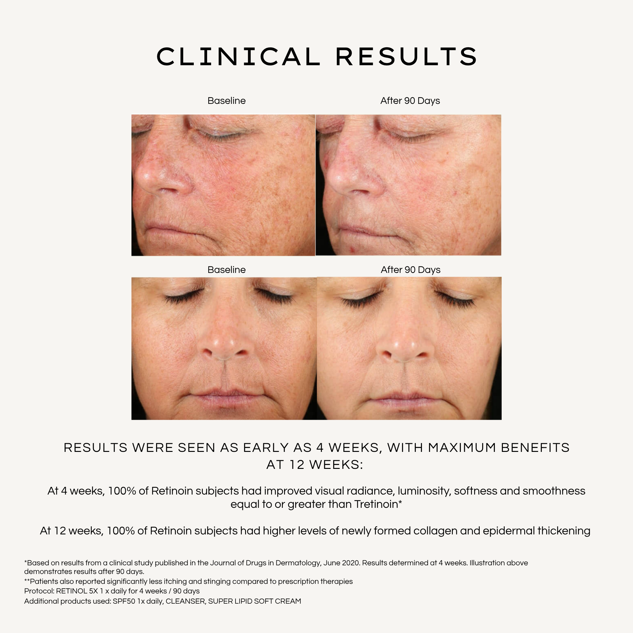 Retinol / Micro-Encapsulated Retinol