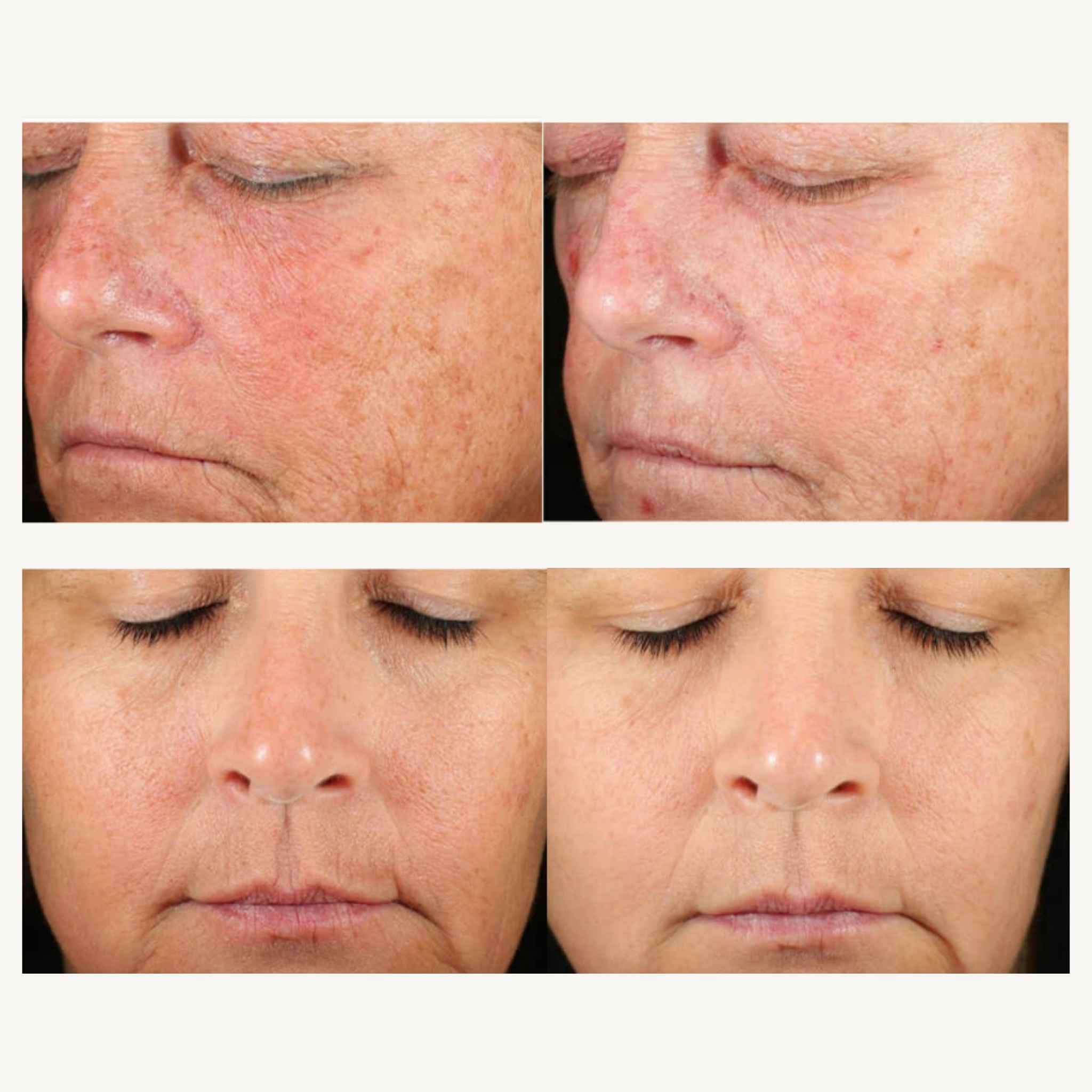 REBEL X retinol serum before and after clinical study comparison showing two mature women with dramatically reduced fine lines, improved skin texture, diminished crow's feet, and enhanced radiance demonstrating anti-aging retinol results