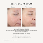 REBEL X HydraFirm Cellular Serum clinical results infographic showing before and after photos at 6 weeks with statistical data: 90% showed tactile smoothness, 80% reduction in wrinkles and fine lines, 70% visible firmness, and 100% reported hydrated softer skin with more even tone