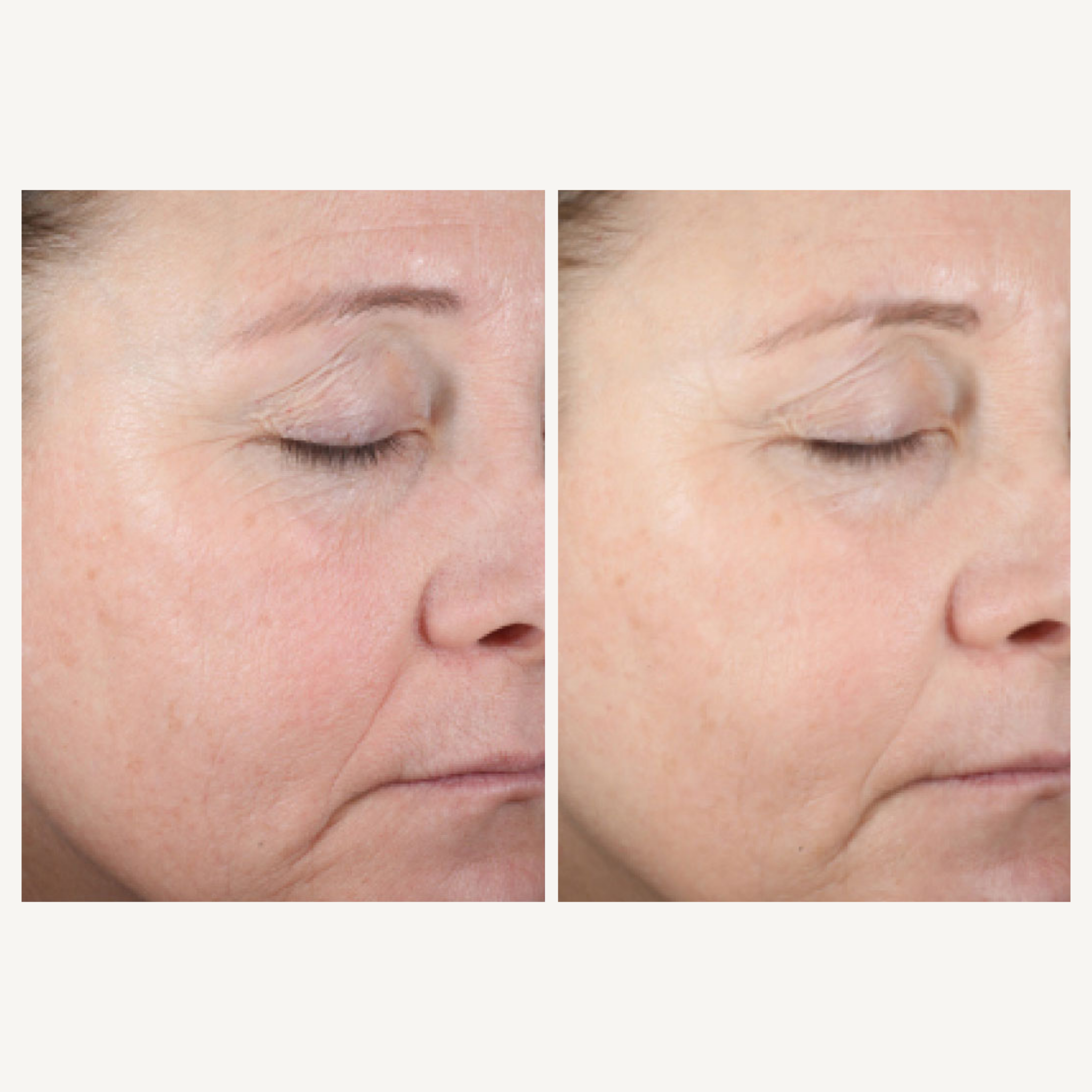 REBEL X HydraFirm Cellular Serum before and after clinical study comparison showing mature woman's face with dramatically improved hydration, reduced fine lines, firmer skin texture, and enhanced radiance demonstrating cellular renewal results