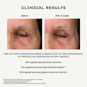 REBEL X EyeLift eye cream clinical results infographic showing before and after photos at 4 weeks with circled eye area demonstrating statistical data: 90% reduction in periocular wrinkles, 90% smoother eye area, 93% instantly brighter appearance, and 93% more taut and firm results