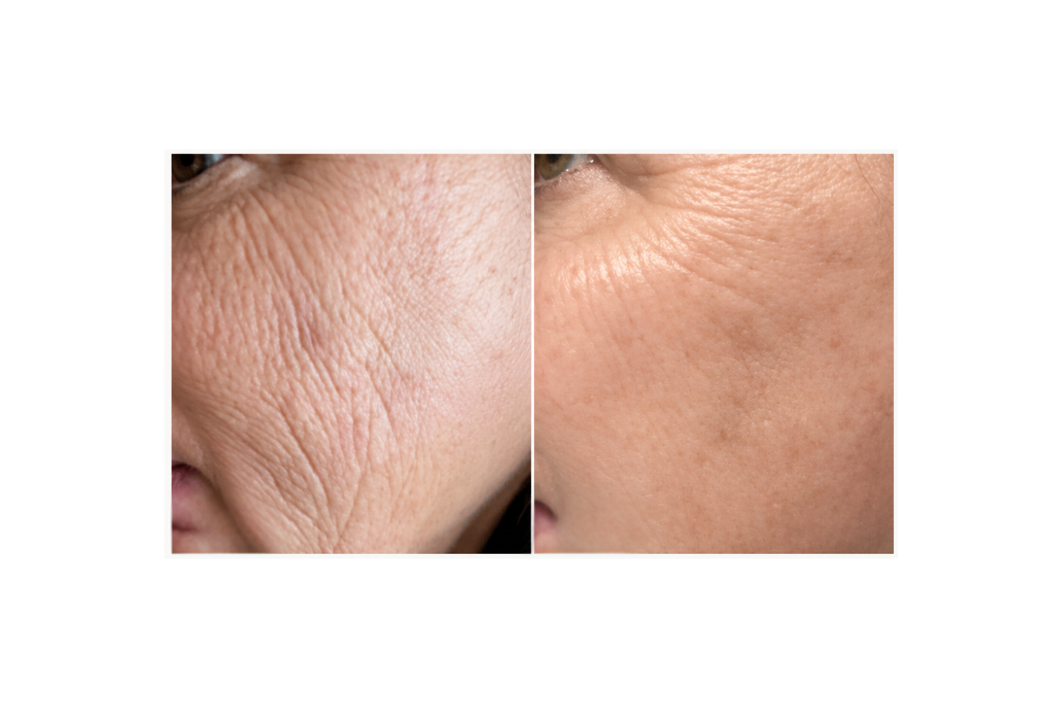 Retinol Micro-Encapsulated Serum