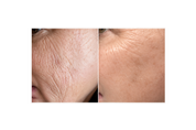 Retinol Micro-Encapsulated Serum